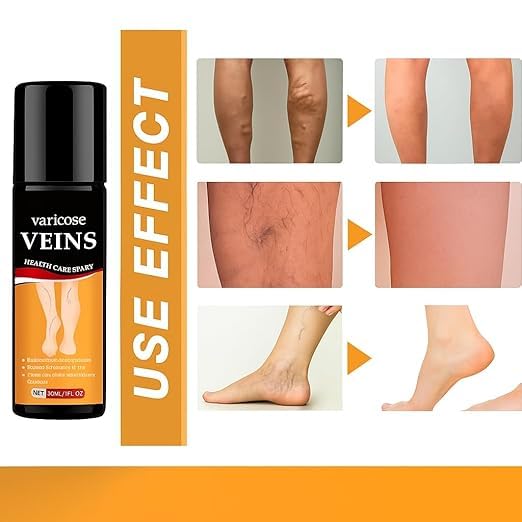 Varicose Veins Spray Leg & Vein Relief Spray (Pack of 2)
