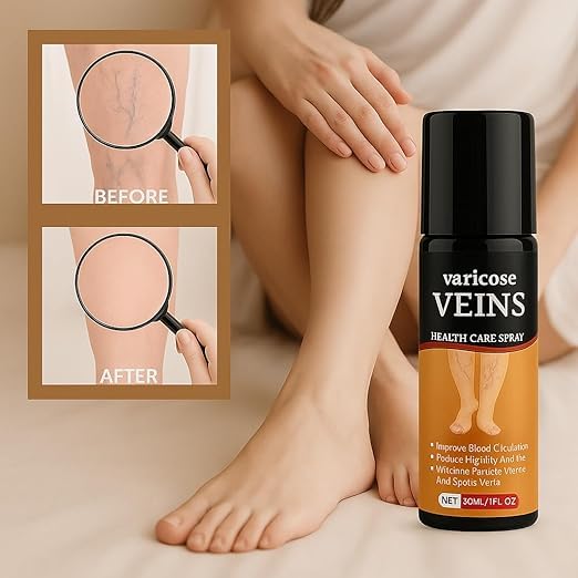 Varicose Veins Spray Leg & Vein Relief Spray (Pack of 2)