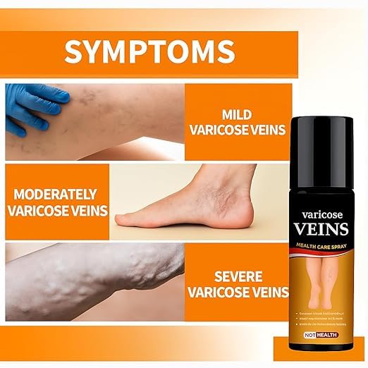 Varicose Veins Spray Leg & Vein Relief Spray (Pack of 2)